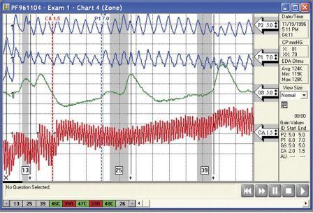 Polygraph Chart Analysis